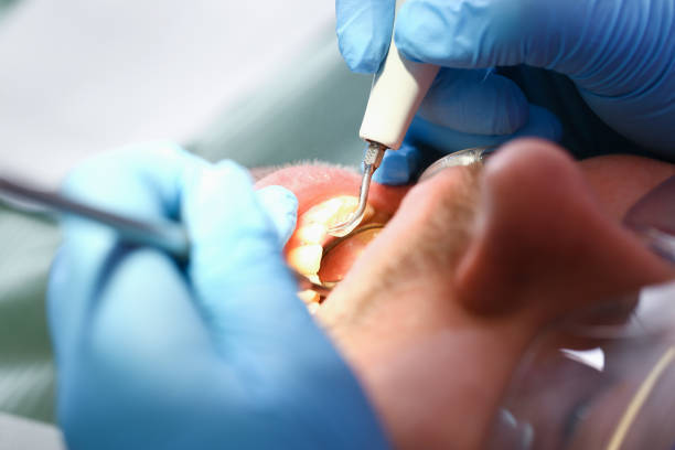 Best Tooth Infection Emergency Dentist  in Fort Sumner, NM