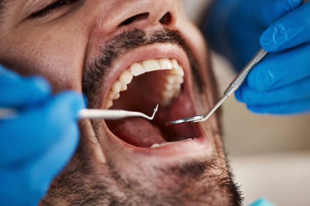 Tooth Infection Emergency Dentist in NM